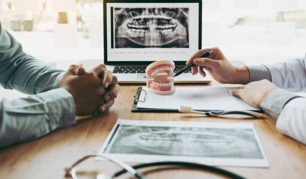 Dental Bonding in San Carlos, CA